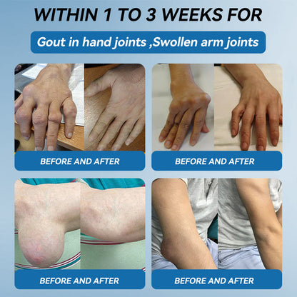 Croaie® BPC-157 Joint Healing Cream🦴Treats Arthritis, Neuropathy, Rheumatism, Sports Injuries & More🏆