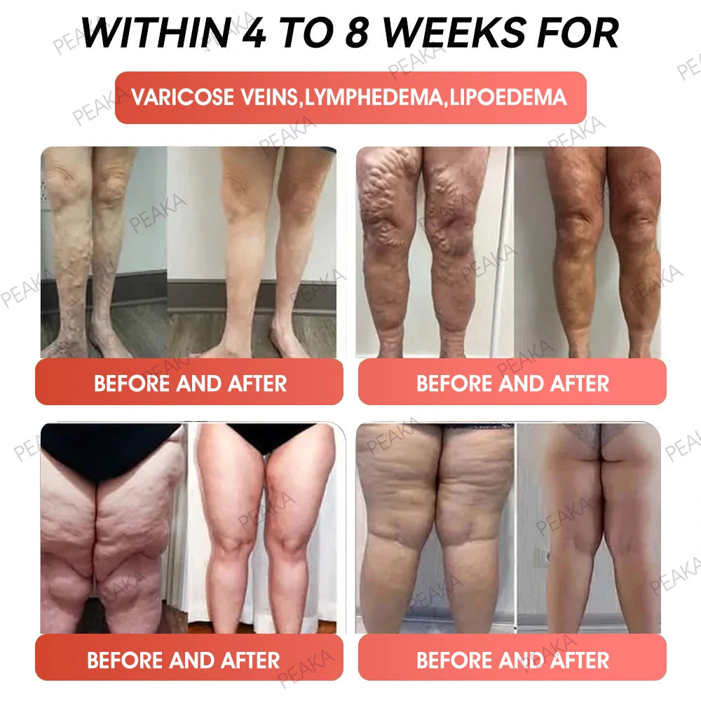 | 𝐎𝐟𝐟𝐢𝐜𝐢𝐚𝐥 Australia 𝐒𝐭𝐨𝐫𝐞 | 🇦🇺 PEAKA® GLP-1 Natural Happy Estrogen Balance · Double-Layer Nanoliposome Microcapsules ·Easy-to-Swallow for Middle-Aged & Older Adults💪For obesity, diabetes, menopause relief, sleep, gut & joints)