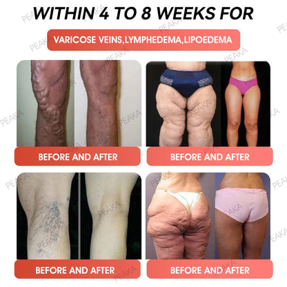 | 𝐎𝐟𝐟𝐢𝐜𝐢𝐚𝐥 Australia 𝐒𝐭𝐨𝐫𝐞 | 🇦🇺 PEAKA® GLP-1 Natural Happy Estrogen Balance · Double-Layer Nanoliposome Microcapsules ·Easy-to-Swallow for Middle-Aged & Older Adults💪For obesity, diabetes, menopause relief, sleep, gut & joints)